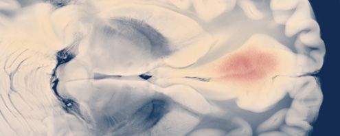 November Newsletter